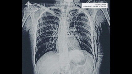 Dept Q - Episode 1x09 - 063