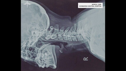 Dept Q - Episode 1x09 - 064